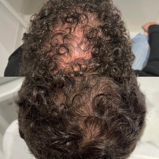 Before and after Signature Pack - diffuse shedding